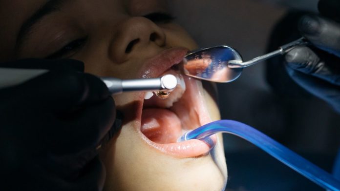 Surgery For Wisdom Teeth